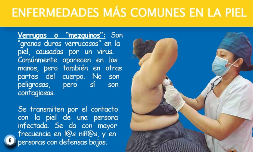PIEL