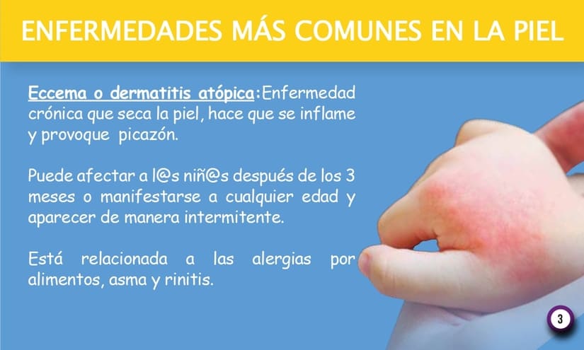 PIEL