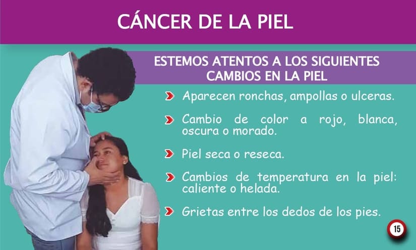 PIEL