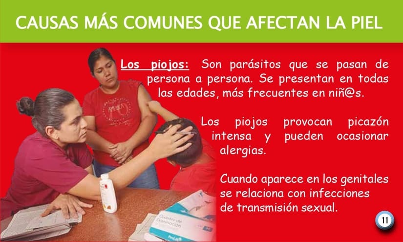 PIEL